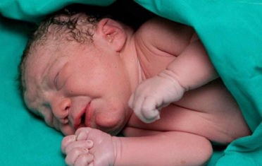 Studi: 1 dari 10 Bayi Di Seluruh Dunia Lahir Prematur, Sangat Berdampak Pada Kesehatan